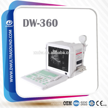 tragbare Ultraschallgeräte und Ultraschalldiagnosescanner DW360